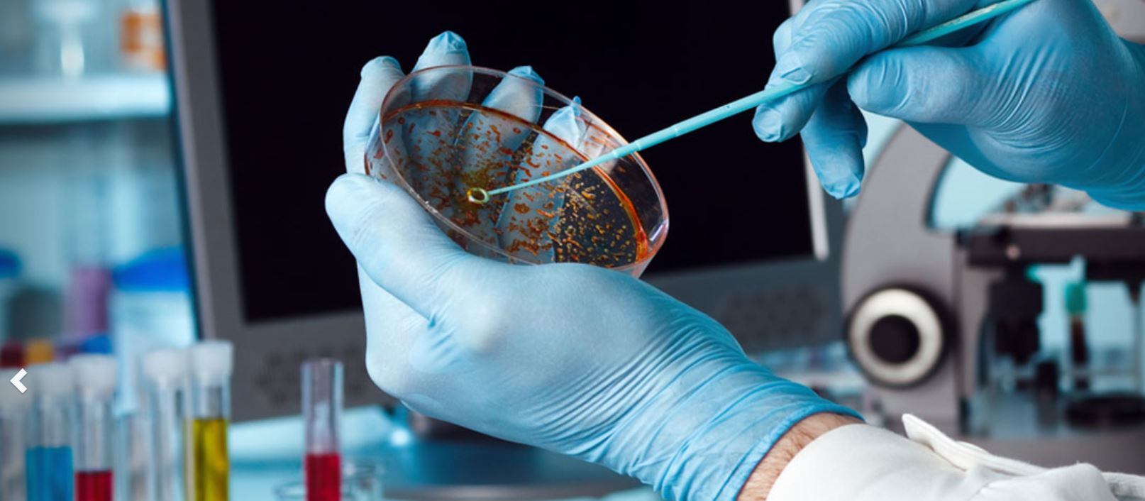 Antibacterial agents: Global Biolife developing functional fragrance to fight tuberculosis