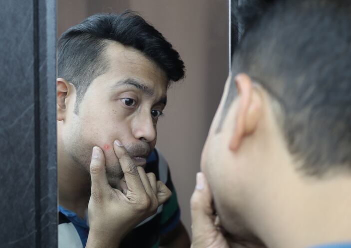 Acne achievement: Postbiotic achieves same results as standard benzoyl peroxide treatment - Study