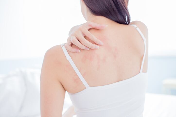 Skin mycobiome versus microbiome: Why fungal diversity may hold key to sensitive skin solutions