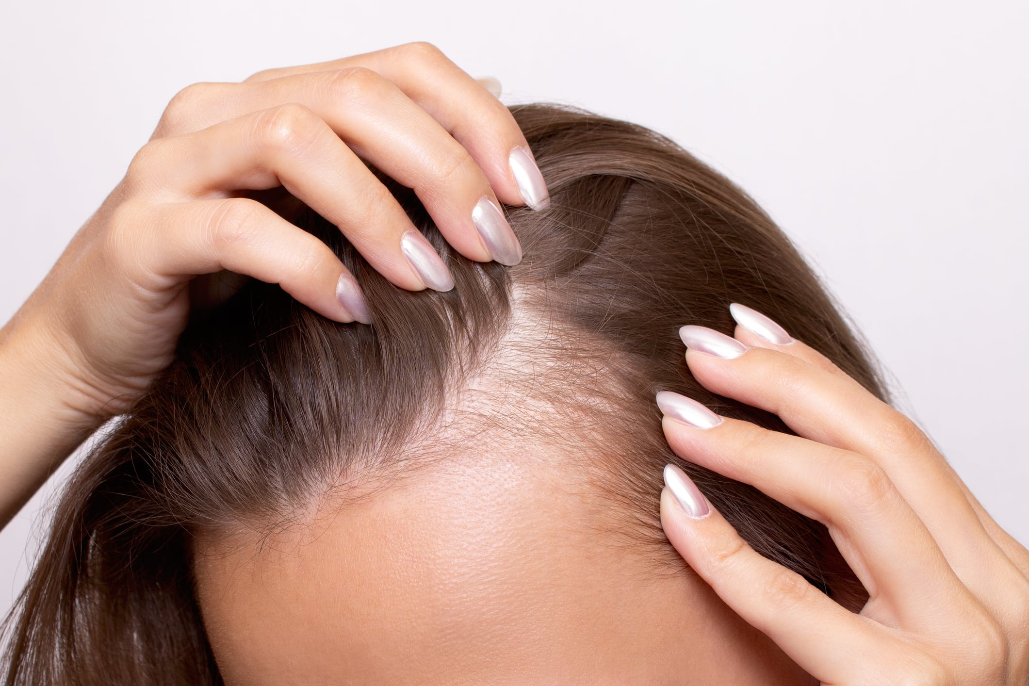 ‘Next-gen’ scalp solution: Cosmax ingredient address co-occurrence of hair loss and seborrheic dermatitis