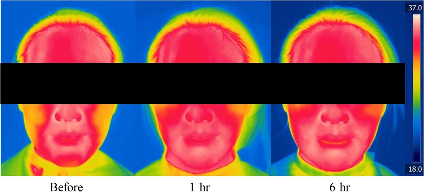Mask impact: Amorepacific research demonstrates how skin is affected by long-term use of protective face masks