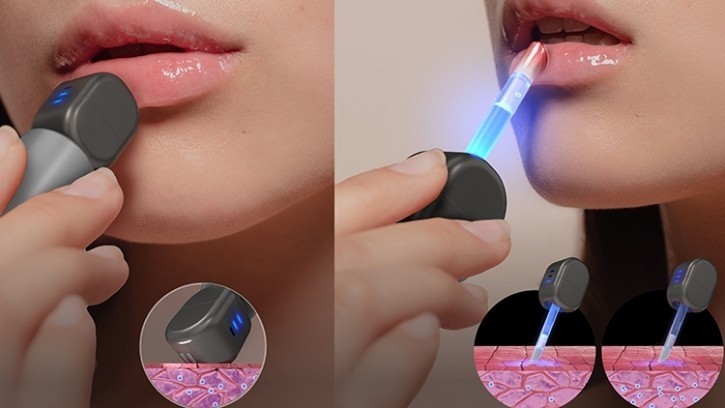 Beauty tech torch bearer: Amorepacific fills gap in lip care with new multifunctional device