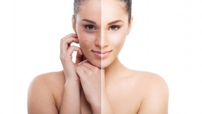 Study uses novel technology to show skin lightness decreases with age