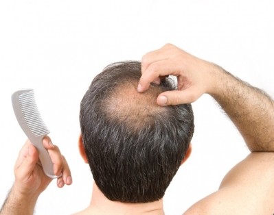 Wanna beat the bald? Shiseido starts research on hair regenerative medicine