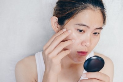 Researchers have discovered that topical brimonidine gel (0.33%) was effective in reducing alcohol-induced facial erythema (redness) in East Asians with alcohol flushing syndrome, for up to two hours ©Getty Images