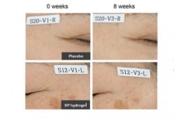 Researchers say this is the first clinical study evaluating the efficacy of the topical application of SP on wrinkle reduction ©Da Jung Kim et al
